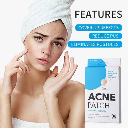 Acne Pimple Patches – Overnight Absorbing Stickers for Clearer Skin